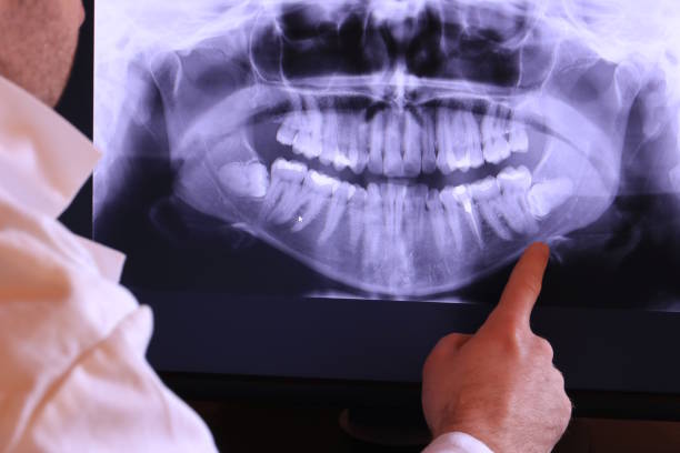 Best Emergency Dental Care for Broken or Chipped Teeth in North Branch, MI