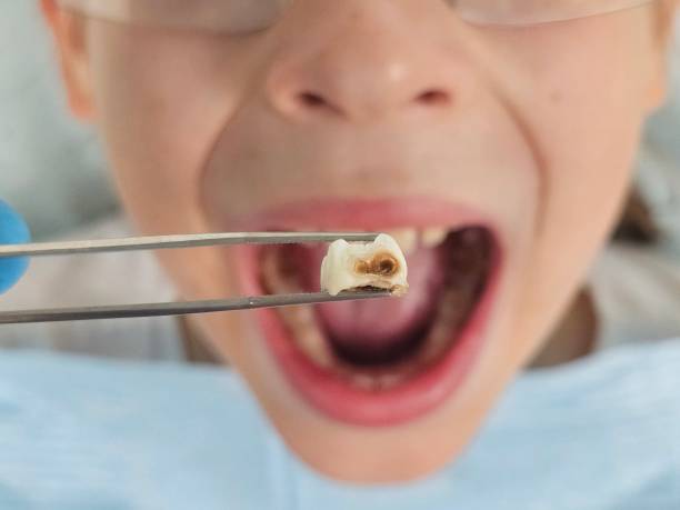 Best Emergency Denture Repair in North Branch, MI